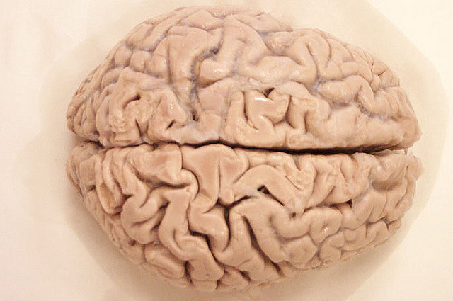 brain-hemisphere